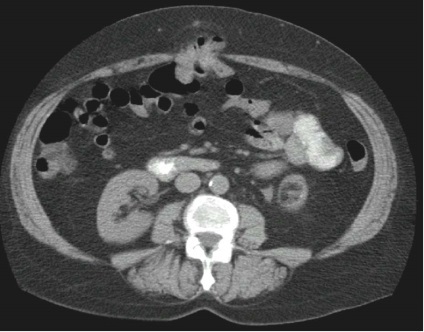 Diagnosticul herniilor abdominale la St. Petersburg - o pagină a Dr. Ivanov