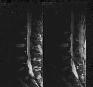 Diagnosticul herniilor abdominale la St. Petersburg - o pagină a Dr. Ivanov