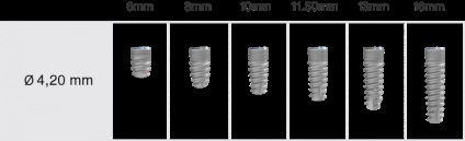 Імплантат з шестигранним з'єднанням mis seven - mis implants russia i імплантати mis