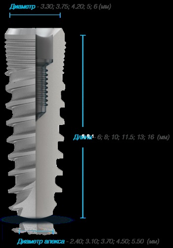 Implant cu legătură hexagonală șapte - implanturi greșite Rusia și implanturi greșite