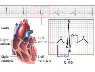 Infarctul miocardic ceea ce este, un istoric medical