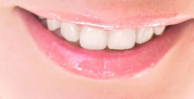 Як можна в домашніх умовах відбілити зуби народні рецепти і рекомендації стоматологів