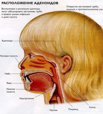 Cum să înțelegeți că un copil are metode adenoide de diagnostic, gât