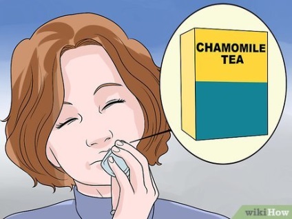 Cum să ușurați durerea cu un ulcer din gură