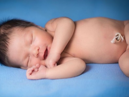 Umflarea buricului la nou-născut cauzează ce trebuie să facă