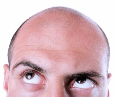 Лікування випадіння волосся у чоловіків як і чим лікувати, чи можна зупинити