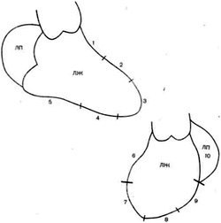 Angiografia ventriculară stângă (ventriculografie)