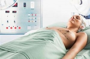 Lipofilling breast (augmentarea sânilor cu grăsime proprie) - ce este, înainte și după fotografii, prețuri, recenzii