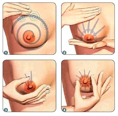 Масаж грудей при маститі у годуючої матері