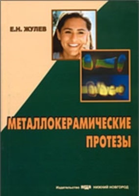 Металокерамічні протези Жулев