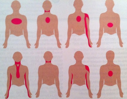 Microinfarction - причини, симптоми, лечение и профилактика