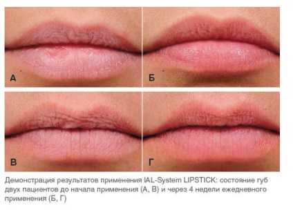 Молоді і гладкі губи c ial-system lipstick! Центр естетичної медицини салон краси діва