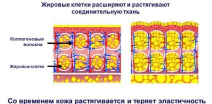 Чи можна робити масаж при місячних спини, попереку і антицелюлітний