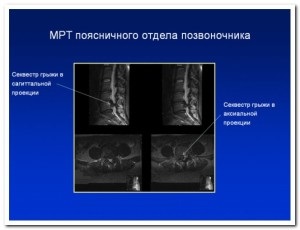 Mr-diagnosticarea coloanei vertebrale și a articulațiilor în lyubertsy