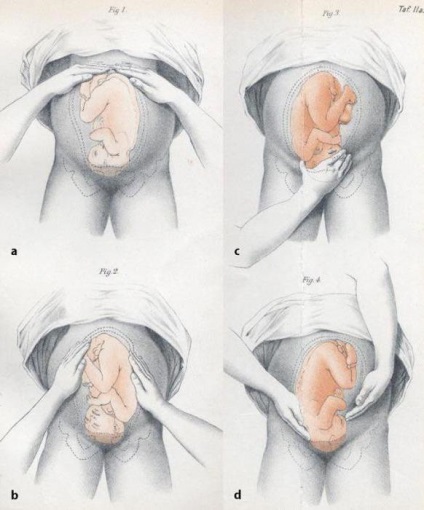 Extern conjugat examen obstetric