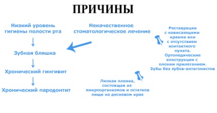 Пародонтит - причини, симптоми, види, лікування і профілактика - доктор зуб