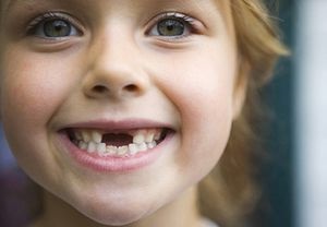 Parodontitisz tejfogainak gyerekek tüneteit, szakaszait paradentózisnál tejfogak