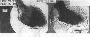 Parametrii hemodinamicii și starea funcțională a miocardului