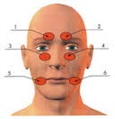 Ajutați-vă cu accident vascular cerebral