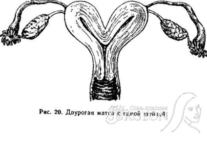 Defectele dezvoltării organelor genitale feminine