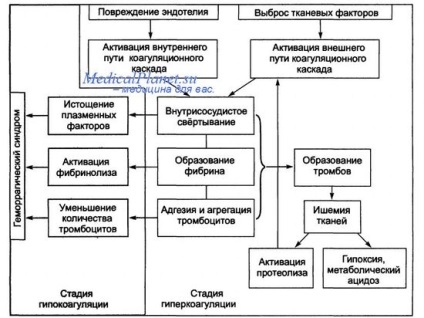 Принципи терапії ДВС синдрому