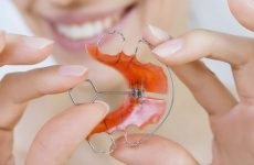 Прямий прикус зубів у людини