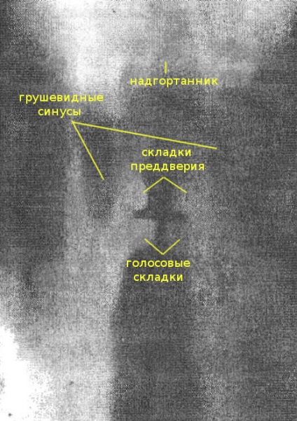 рентгенографія гортані