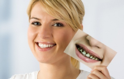 Restaurare dentară clinică dentară - dent-art - în Yekaterinburg - stomatologie dent-art