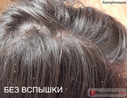 Sampon bőrgyógyászati ​​algopiks - „korpásodás nem szállított, de megszabadulni a hosszú haj! 