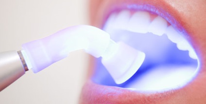 Система відбілювання зубів white smile