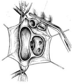 Transplantul de cord la câini - transplant de inimă într-un experiment - transplant de inimă -