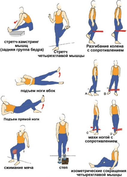 Вправи після ендопротезування кульшового суглоба комплекс ЛФК та ​​гімнастики в домашніх
