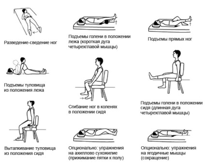 Вправи після ендопротезування кульшового суглоба комплекс ЛФК та ​​гімнастики в домашніх