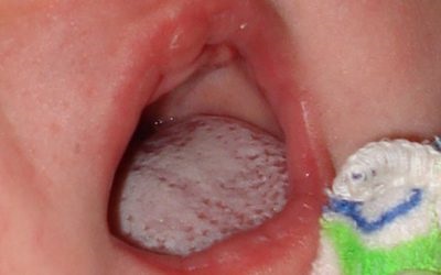 Догляд за молочними і корінними зубами дітей правила і особливості