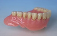 Tipuri de proteze - stomatologie - Heihe - tratament dentar în Heihe, China
