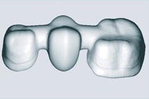 Tipuri de proteze - stomatologie - Heihe - tratament dentar în Heihe, China