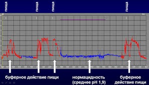 Valoarea pH-metrică intragastrică