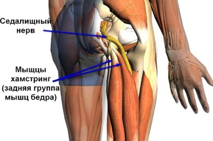 Хамстрінг - синдром - симптоми і лікування