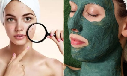 Zöld agyag az arc - a hatás a frissesség és az egészség