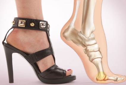 Női ortopéd cipők