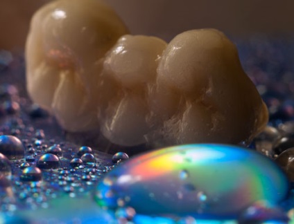 Protezele dentare fără metal