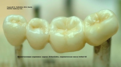 Protezele dentare fără metal