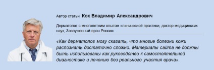 Свербіж та почервоніння шкіри у вигляді плям або кола з лущенням що це