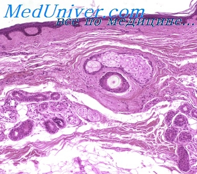 Apocrine és faggyúmirigy (apocrine) Apocrine és faggyúmirigyek