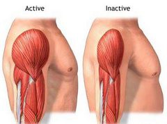 Atrofia musculară - cauze, simptome, tratament