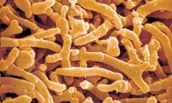Bifidobacterium longum (bifidobacterium longum)