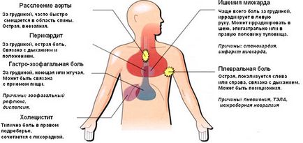 Біль в грудині посередині при вдиху, при натисканні, при русі - причини