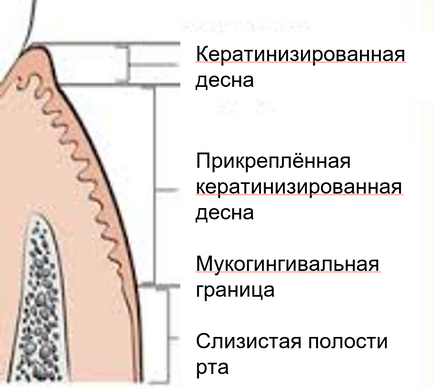 Ceea ce distinge implanturile de dinți, implantarium