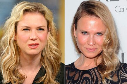 Ce sa întâmplat cu Renee Zellweger, de ce nu arata ca ea însăși