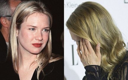 Mi történt Renée Zellweger